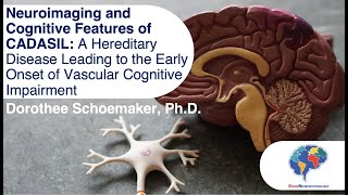 Neuroimaging and Cognitive Features of CADASIL [upl. by Brindell]