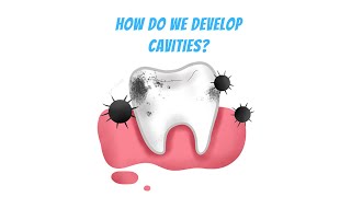 CAN YOU CURE CAVITIES AT HOME [upl. by Ellinnet451]