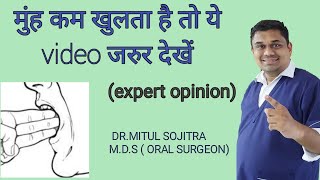 मुन्ह कम खुलने इलाज  Oral submucous fibrosis Causes and Treatment EXPERT ADVICE [upl. by Renat859]