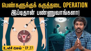 குடும்பக் கட்டுப்பாடு சிகிச்சைல இவ்ளோ சிக்கல் இருக்கா  Women family planning tamil  Uyirmei Ep27 [upl. by Aleta]