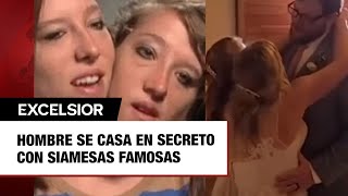 Hombre se casa en secreto con siamesas famosas [upl. by Ahsiuq]