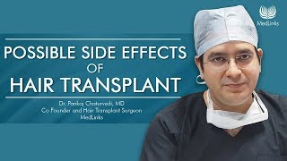 Side Effects of Hair Transplant IN 2024  Well Explained by Dr Pankaj Chaturvedi  MedLinks [upl. by Anhoj]