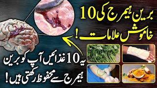 What Happens In Brain Hemorrhage  Symptoms Causes And Treatment Urdu Hindi [upl. by Eves]