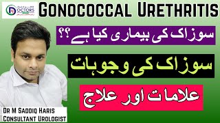 Gonorrhea Gonorrhea Treatment  Gonorrhea Meaning  SOZAK  سوزاک کیا ہے؟  سوزاک کا علاج [upl. by Anivlem]