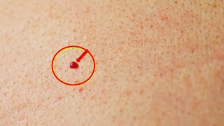 Do you have red spots on your skin Heres what they mean [upl. by Evie]