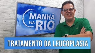 Leucoplasia Oral sintomas causas e tratamentos  Manhã na Rio [upl. by Assille]