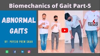 Antalgic gait Hemiplegic gait All Abnormal Gait Demonstration Gait biomechanics [upl. by Eriuqs]