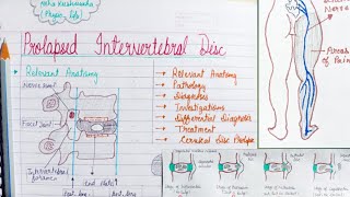 Prolapsed intervertebral discPIVD  part1 [upl. by Figge]