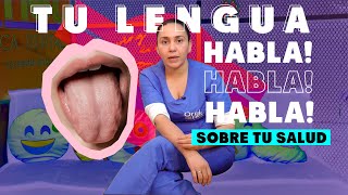 Qué esta diciendo tu lengua sobre tu salud  Oralnet [upl. by Nuahsyd]