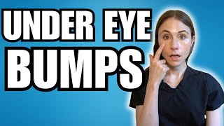 What Are Those Bumps Under The Eyes  Dermatologist Explains [upl. by Felicle]