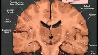 Neuroanatomy  Coronal Brain Slices [upl. by Cho80]