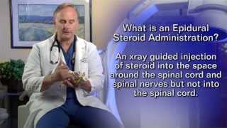 Epidural Steroid InjectionPatient Education Video [upl. by Nnovahs298]