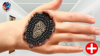 😱💉 Asmr Palm Cleaning  Asmr Deep Cleaning  Asmr Palm Treatment  2d Asmr Animation 🎧 [upl. by Wrench]