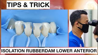 Tips and Trick Isolation With Rubberdam Lower Anterior Without Clamp  General Dentist Griya RR [upl. by Leid272]