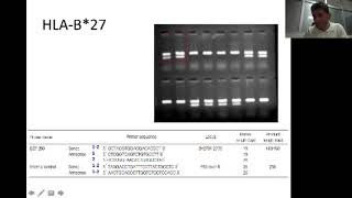 Moleküler Tanı YöntemleriI PCR ElektroforezPart2 [upl. by Tekla838]