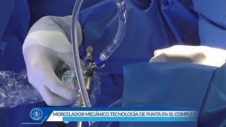 MORCELADOR MECÁNICO TECNOLOGÍA DE PUNTA PARA LA EXTRACIÓN DE MIOMAS [upl. by Yhtorod312]