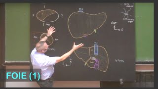 Comment  Réaliser une échographie de la vésicule biliaire  Partie 3  Cholécystite [upl. by Rbma289]