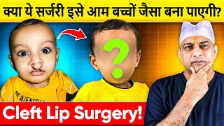 क्या आपका बच्चा इस समस्या से जूझ रहा है Cleft Lip and Palate  Plastic Surgery at Saraswat Hospital [upl. by Dranrev]