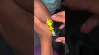 Iv Cannula Fixing youtubeshorts ytshorts doctor [upl. by Schenck]