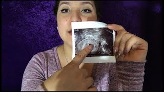 My First Ultrasound 5weeks 2daysNo Yolk Sac Yet [upl. by Meurer]