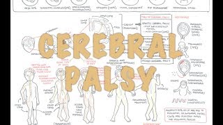 Cerebral Palsy  DETAILED Overview [upl. by Luben]