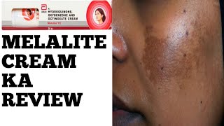 Melalite Cream Review in Hindi [upl. by Joe]