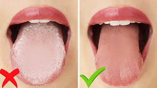 HOW TO Get Rid of White Tongue amp Bad Breath INSTANTLY [upl. by Ennail903]