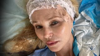 Christie Brinkley Reveals She Has Skin Cancer [upl. by Tybie]