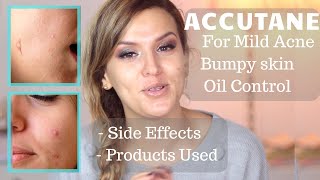 ACCUTANE  ROACCUTANE FOR MILD ACNE OILY SKIN AND STUBBORN SKIN BUMPS  LOW DOSE 20Mg SIDE EFFECTS [upl. by Partridge]