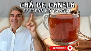 Saiba por que o Chá de Canela é seu Aliado no Controle de Açúcar no Sangue Dr Nelson Marques [upl. by Sosna852]