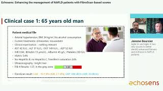 FibroScan®based Scores in NAFLD patient management [upl. by Reyaht336]