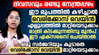 ദിവസവും രണ്ടു നേന്ത്രപ്പഴം ഈ രൂപത്തിൽ കഴിച്ചാൽ വെരിക്കോസ് വെയിൻ എളുപ്പത്തിൽ മാറ്റിയെടുക്കാം [upl. by Jea]