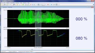 Measuring nasality with the Nasality Microphone [upl. by Bhayani]