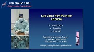 Live Case Presentation 1 Chimney EVAR for Type Ia Endoleak [upl. by Griz]