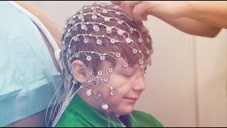 High Density HD EEG Testing Services [upl. by Boykins827]