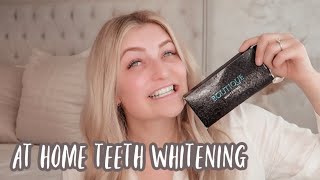 At Home Teeth Whitening  Boutique Whitening  My Teeth Bleaching Journey [upl. by Iverson]