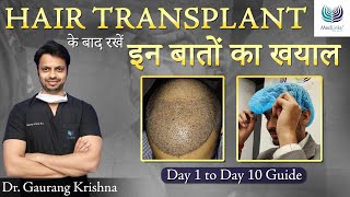 How to Spend the First 10 Days After Hair Transplant  Precautions after Hair Transplant  Medlinks [upl. by Adnat]