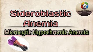 Sideroblastic Anemia in hindi ll Microcytic Hypochromic Anemia ll Hematology And Blood Banking [upl. by Chaing]