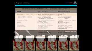 Planejamento do Diagnóstico e Tratamento Endodôntico [upl. by Martin]