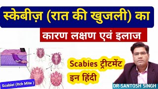 What Are Scabies Signs Symptoms Causes and Treatment  स्केबीज़ रात की खाज खुजली [upl. by Pirbhai]