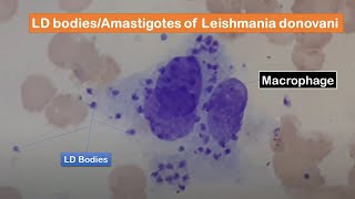 LD bodies Amastigotes of Leishmania donovani in skin smear of a cutaneous leishmaniasis patient [upl. by Mcconaghy822]