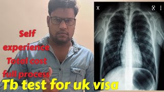 TB test for UK visaUK student visahealth check up for UK visaDocuments requiredcomplete process [upl. by Medwin]