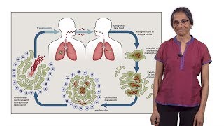 Lalita Ramakrishnan Cambridge 1 Tuberculosis The Pathogenic Personality of the Tubercle bacillus [upl. by Simsar]