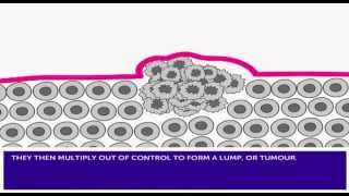 How Cancer Develops amp Mutation [upl. by Mcgaw]