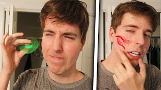 Fidget Spinner Vs Face Legit Had To Get Stitches [upl. by Sheldon]