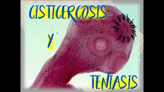 Taenia solium Cisticercosis y Teniasis [upl. by Onaireves]