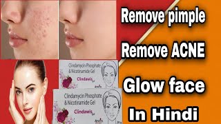 Clindamycin Phosphate gel in hindi  Clindamycin Phosphate gel usp Pimples removal cream  Acne [upl. by Sharia]