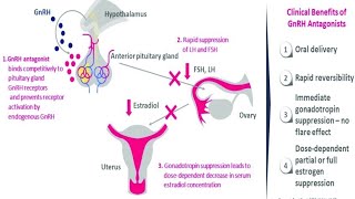 How do GnRH Analogues works  Zoladex  Prostap  Other GnRH Analogues [upl. by Dloniger]