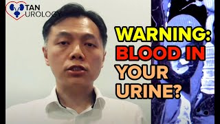 YOU Need To Know About Blood In The Urine  Spot The Warning Signs Early [upl. by Oirad]