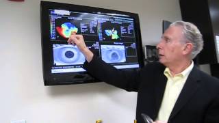 DR BOSHNICK EXPLAINING CORNEAL TOPOGRAPHY PATIENT 4 [upl. by Richma]